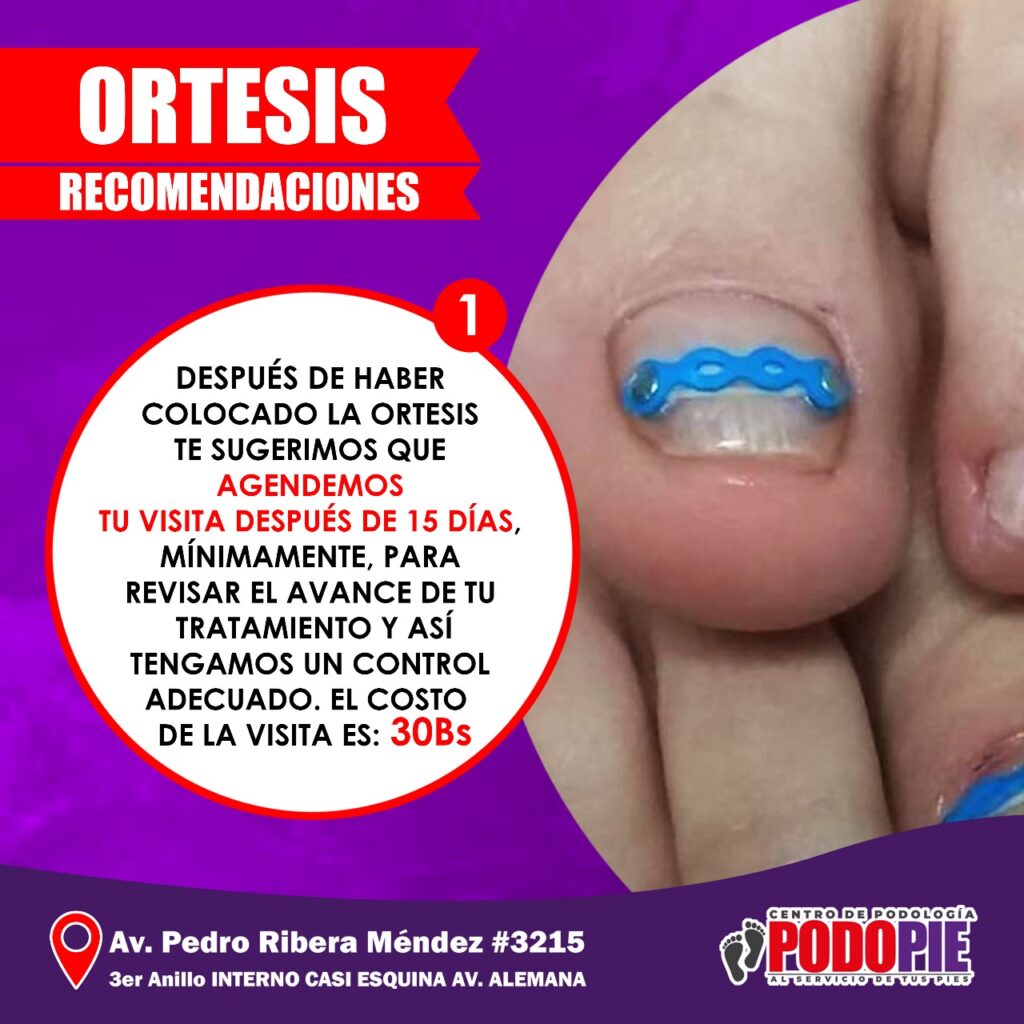 ORTESIS