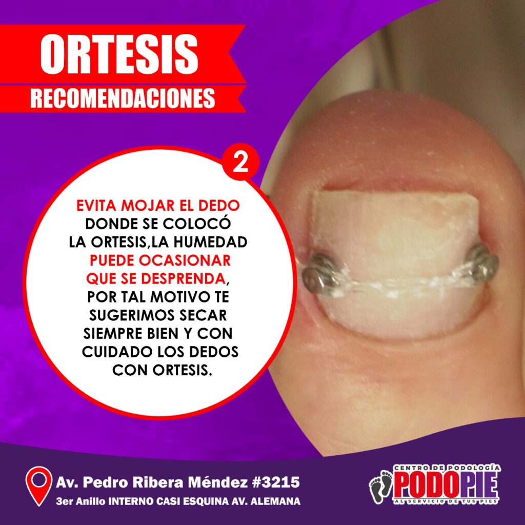 ORTESIS