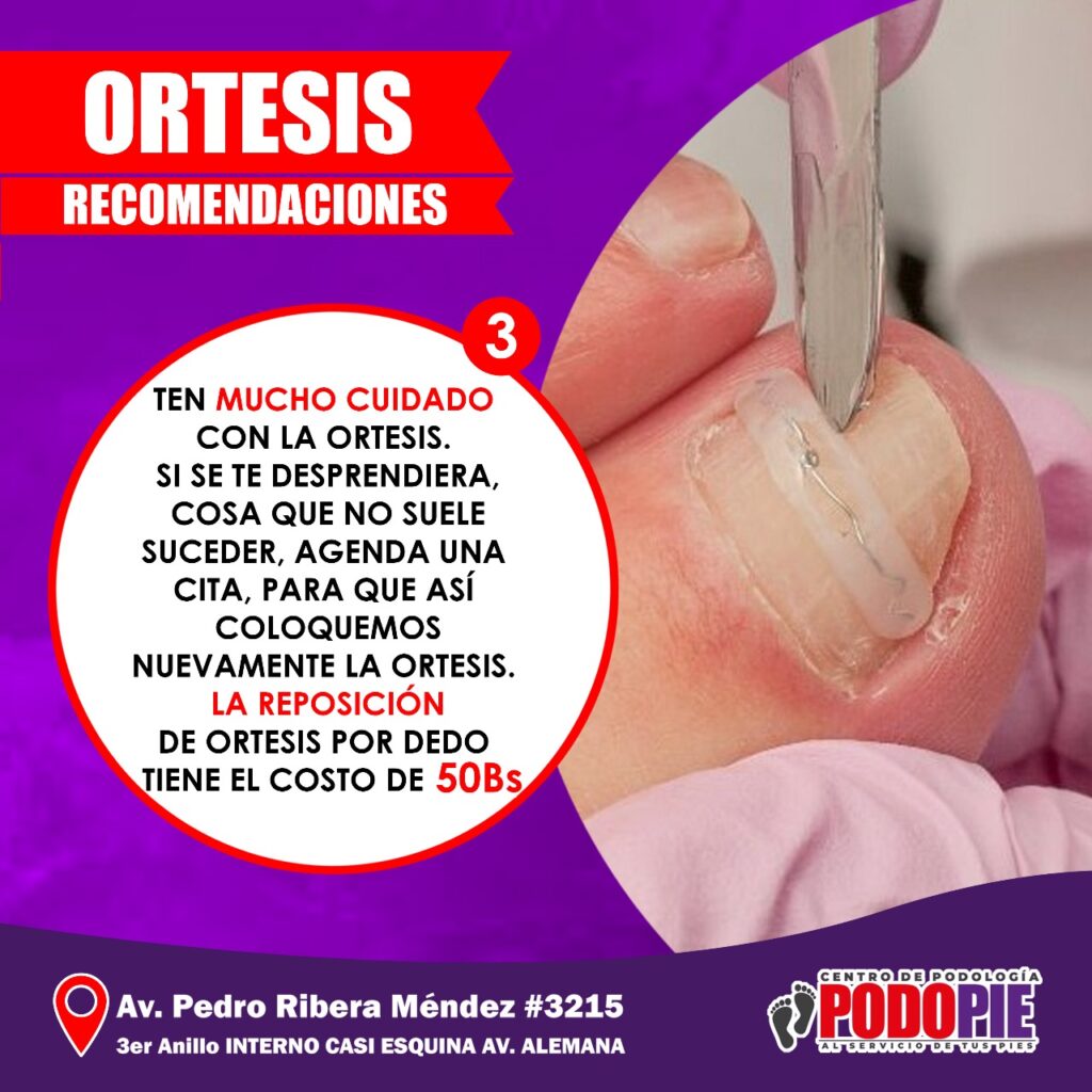 ORTESIS