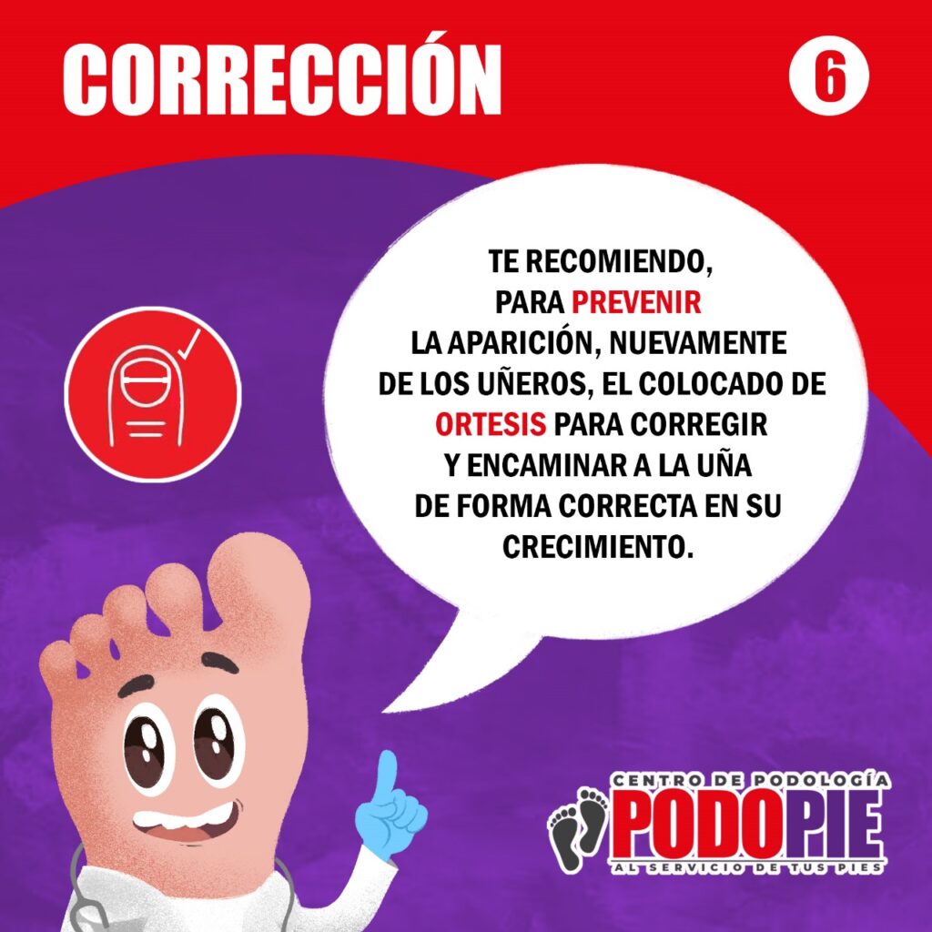 UÑEROS