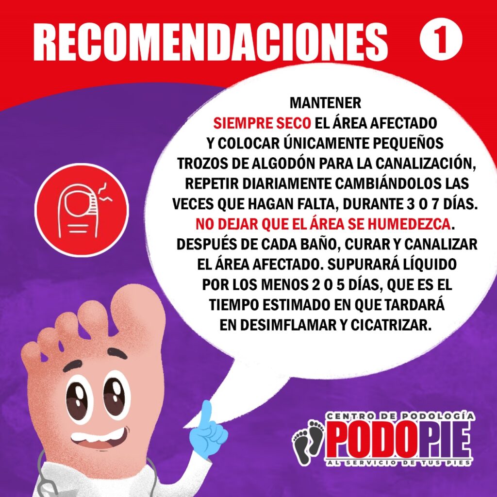 UÑEROS