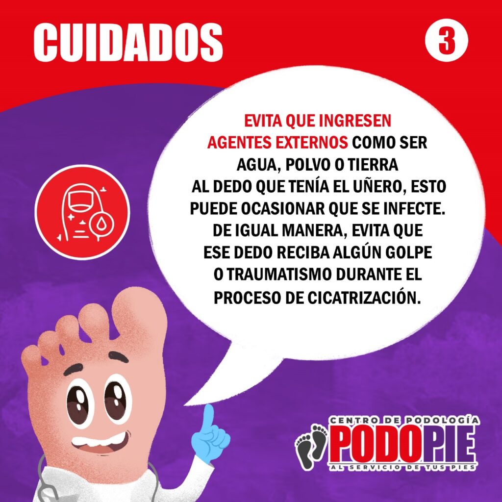 UÑEROS