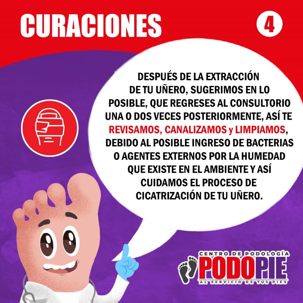 UÑEROS