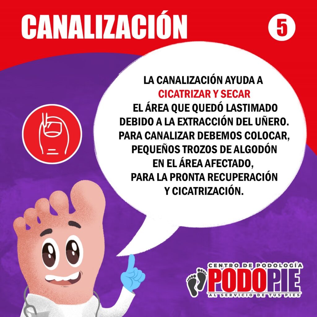 UÑEROS