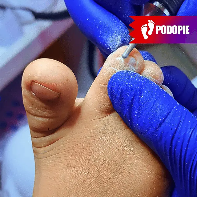 PODOPEDIATRIA